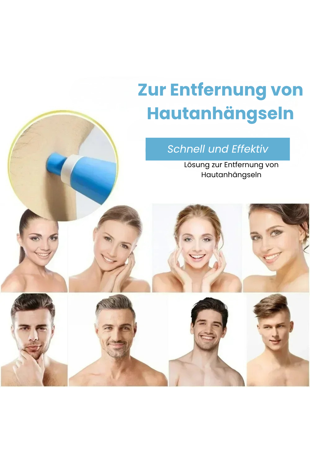 LumiSkin Care Pen | Hautanhängsel mühelos entfernen